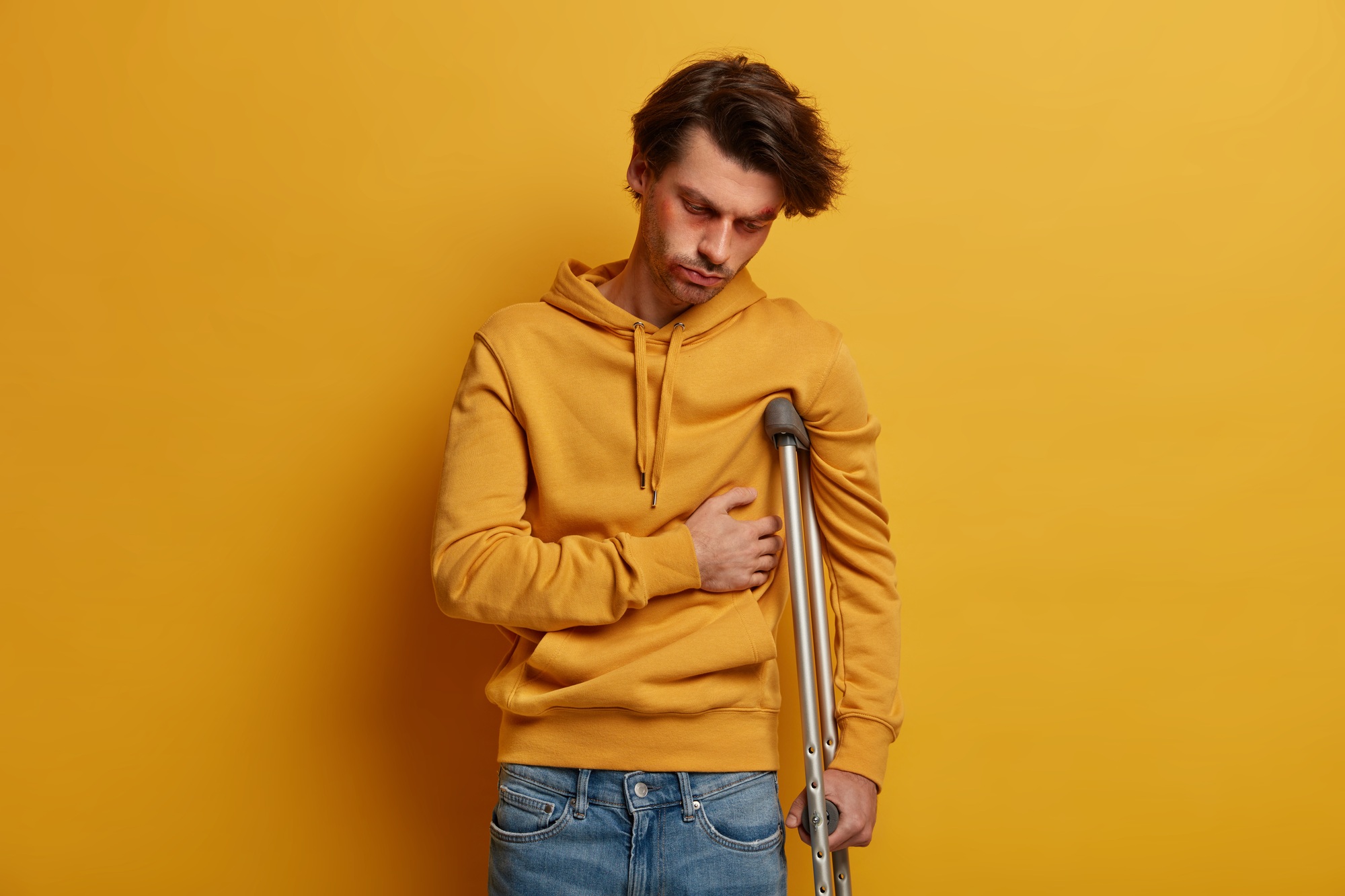 Indoor shot of distressed man has broken rib, suffers from pain, stands on crutches, had accident on
