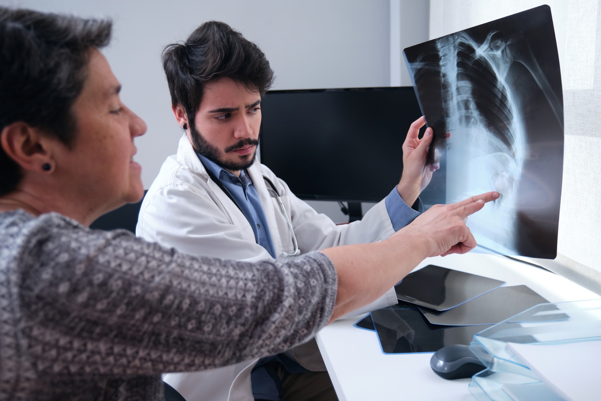 Young doctor examining x-ray of a broken rib with a woman mature patient. Radiography of a chest.
