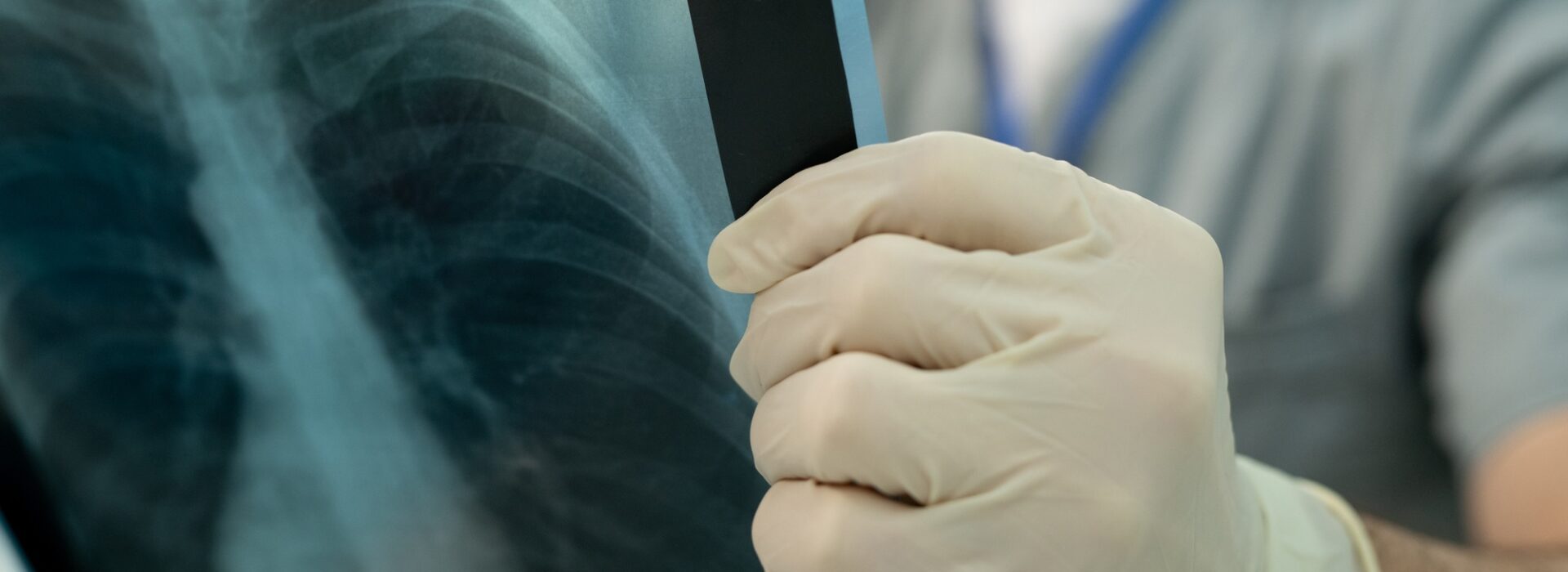 Doctor analyzing lung x-ray image