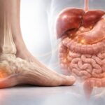 Épine calcanéenne et foie intestin : liens surprenants entre douleur et digestion