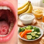 Cloques de sang dans la bouche et alimentation : quels aliments privilégier ?