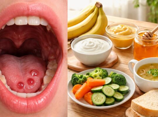 découvrez quels aliments privilégier pour apaiser les cloques de sang dans la bouche et favoriser une meilleure cicatrisation grâce à une alimentation adaptée.