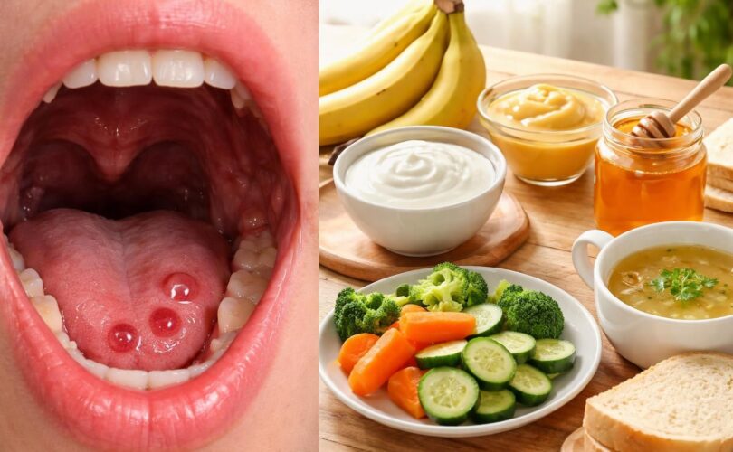 découvrez quels aliments privilégier pour apaiser les cloques de sang dans la bouche et favoriser une meilleure cicatrisation grâce à une alimentation adaptée.